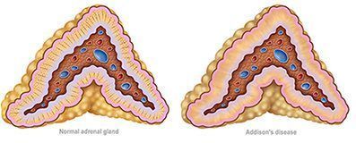Comparación Glándula adrenal 