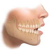 Mandíbula y Dentadura