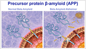 Proteína beta amiloide de Alzheimer