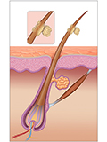 Hongo Trichosporon