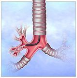 Bronchoscopy examination