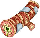 Bronquiolo asmático
