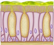 Celulas mucuosas alteradas