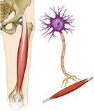 Debilitamiento muscular en esclerosis