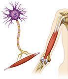 Esclerosis lateral