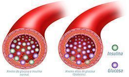  insulina y glucosa