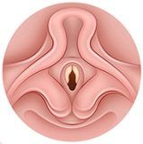 Laringomalacia