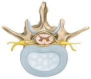 Vértebra lumbar
